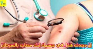 أخطر 10 علامات مبكرة