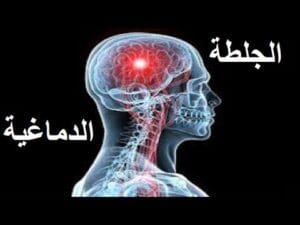 أنواع الجلطات الدماغية