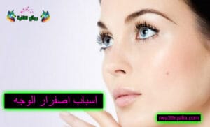 اسباب اصفرار الوجه