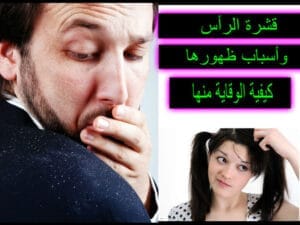 قشرة الرأس وأسباب